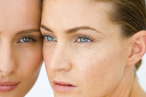 春季激光祛斑需要注意什么