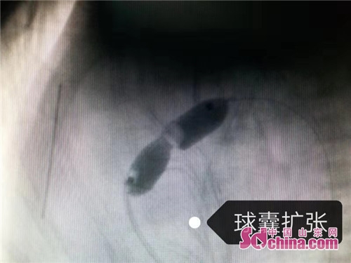 5cfe077e-b7b3-4f7a-9f92-fa9c1951b8d1.JPG