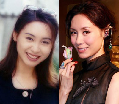 揭秘娱乐圈当红女星整容前后对比