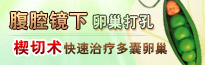 腹腔镜下卵巢打孔楔切术