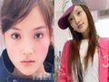 身陷整形风波女星