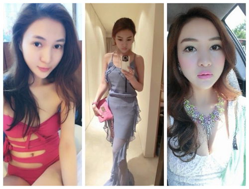 郭美美李小璐杨幂郑爽霍思燕 整容前后大 变脸 